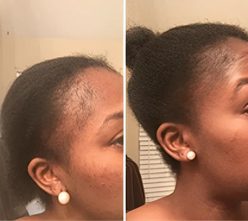 Cápsulas Hair Growth